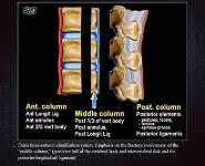 Thoracic Spine Trauma PowerPoint Presentation
