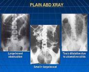 IMAGING OF THE ABDOMEN and THE GIT PowerPoint Presentation
