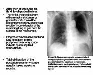 Post Operative Chest Imaging PowerPoint Presentation