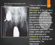 Musculoskeletal imaging Rapid review of radiology PowerPoint Presentation
