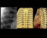 Cases in Pediatric Radiology PowerPoint Presentation