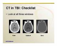 Imaging of Traumatic Brain Injury PowerPoint Presentation