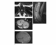IMAGING OF PENIS PowerPoint Presentation
