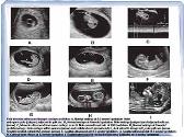 Overview of Obstetric Imaging and The First Trimester