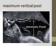 Radiology and Imaging in OB-GYN PowerPoint Presentation