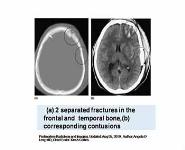 Forensic Radiology PowerPoint Presentation