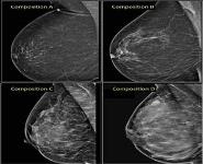 IMAGING BREAST CANCER PowerPoint Presentation