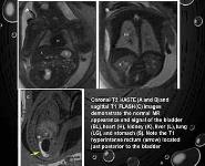 FETAL MRI PowerPoint Presentation