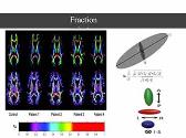 Diffusion tensor image in neurology
