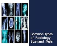 Common Types of Radiology Scan and Tests PowerPoint Presentation