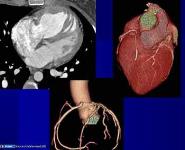 Basic Cardiac Radiology PowerPoint Presentation