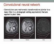 ARTIFICIAL INTELLIGENCE AND RADIOLOGY PowerPoint Presentation