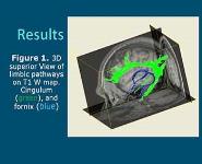 Research in Radiology PowerPoint Presentation