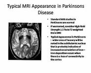 Rehabilitation Management of Parkinsons Disease PowerPoint Presentation