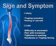 Importance of Physiotherapy in Hemophilia PowerPoint Presentation