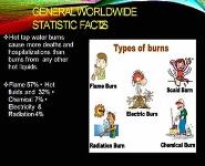 BURNS IN PEDIATRICS PowerPoint Presentation