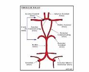 Pediatric Stroke PowerPoint Presentation