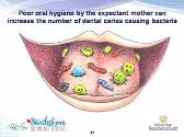 Oral Health for Mothers, Infants and Children