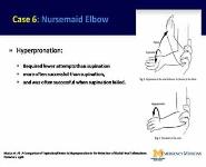 Common Acute Pediatric Urgent Issues Encountered in Primary Care Settings PowerPoint Presentation