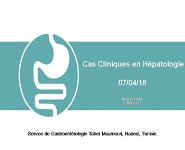 pancreas PowerPoint Presentation