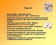 Anemias in children PowerPoint Presentation