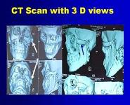 WHAT IS NEW IN HEAD AND NECK CANCERS PowerPoint Presentation