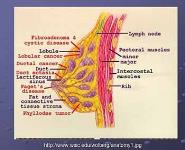 Breast Cancer Research PowerPoint Presentation