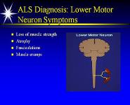Motor Neuron Diseases PowerPoint Presentation
