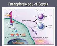Sepsis-Pathophysiology and Treatment PowerPoint Presentation
