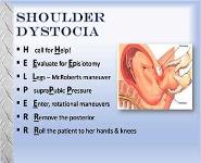 OB EMS Emergencies PowerPoint Presentation