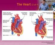 Bleeding PowerPoint Presentation