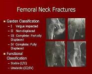 Lower Extremity Trauma PowerPoint Presentation