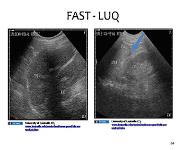 Initial Assessment and Management of the Trauma Patient PowerPoint Presentation