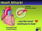 Automated External Defibrillators