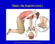 Emergency Cardiovascular Life Support PowerPoint Presentation