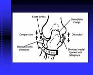 Elbow PowerPoint Presentation