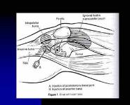 Gout and Pseudogout PowerPoint Presentation