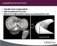 Meniscus Injuries PowerPoint Presentation