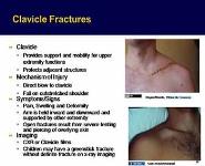Upper Extremity Injuries-Shoulder Elbow and Wrist PowerPoint Presentation