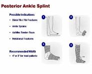 Splinting and Casting PowerPoint Presentation