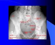 Diagnostic Imaging of Bones and Joints PowerPoint Presentation
