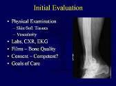 Epidemiology Diagnosis Prevention and Management of Osteoporotic Fractures