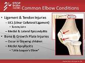STOP Elbow Injuries
