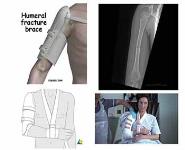 COMMON FRACTURES PowerPoint Presentation