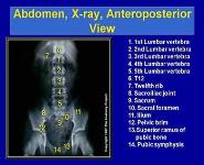 Low Back Pain-Approach to the patient in the E D PowerPoint Presentation