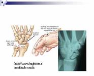 Wrist and Hand Anatomy PowerPoint Presentation