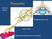 Peripheral nerve disorders-A practical overview