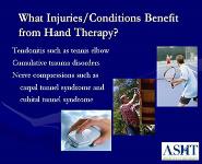 WHAT IS HAND THERAPY PowerPoint Presentation