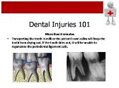 Dental Injuries