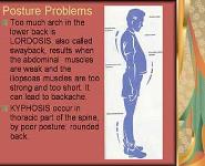 Back Problems - Screening and Prevention Tips PowerPoint Presentation